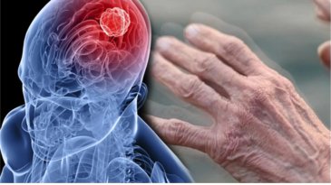 Pl&aacute;stico reciclado convertido en medicamento para el Parkinson