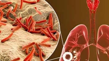 Cient&iacute;ficos encuentran un descubrimiento prometedor para f&aacute;rmacos contra la tuberculosis.