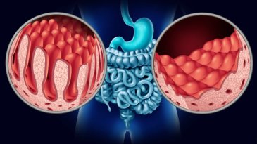 Enfermedad cel&iacute;aca: Biolog&iacute;a, gen&eacute;tica y los mitos de la confusi&oacute;n contempor&aacute;nea
