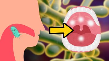 Difteria: la bacteria que no se puede ignorar